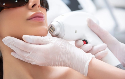 Laser Skin Treatment