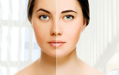 Skin Whitening Cost