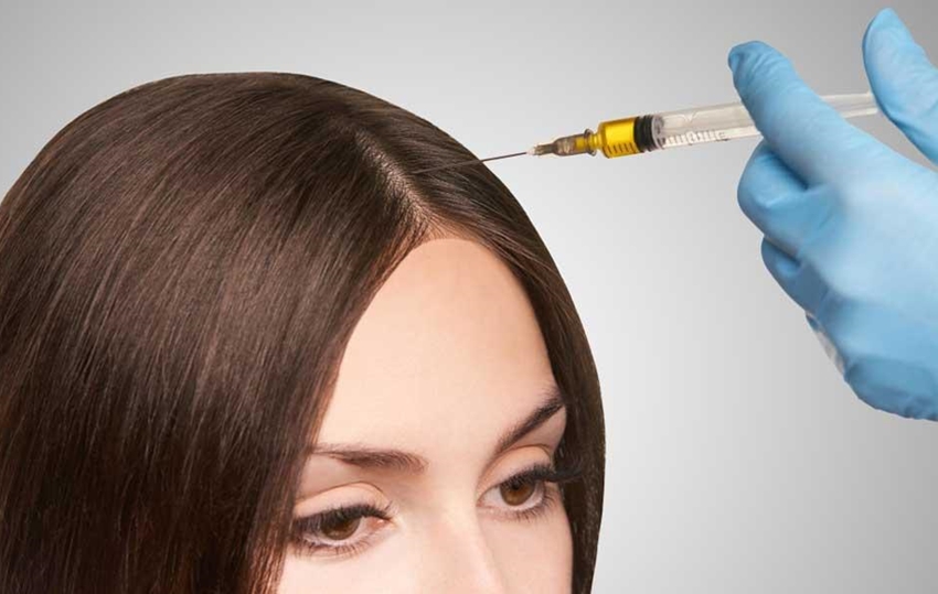 Everything You Need to Know About PRP Therapy for Hair Regrowth